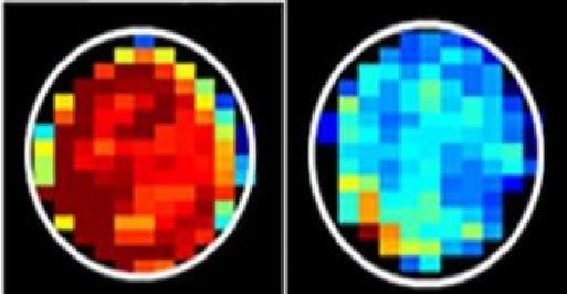 Sugar-Seeking MRI For Cancer Detection