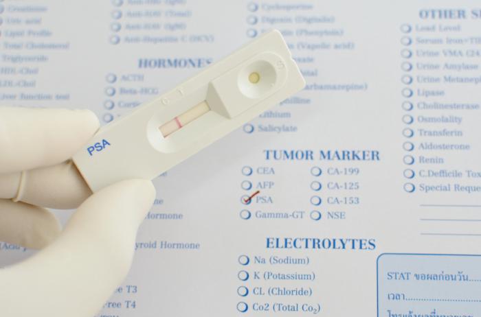 Regular Screening: Where to strike balance?